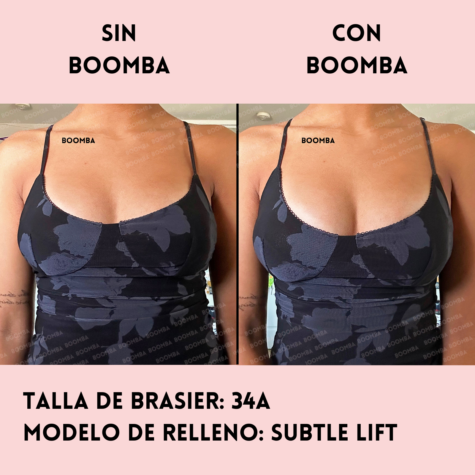 Rellenos Subtle Lift SIZE_A