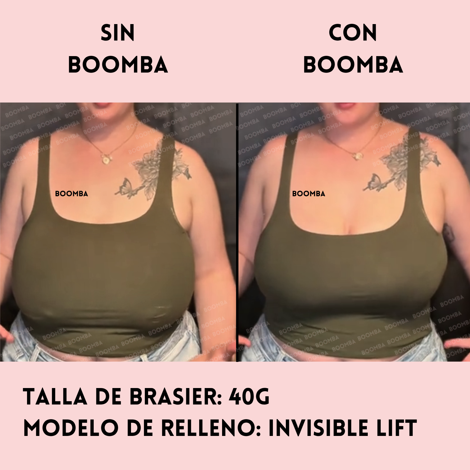 Rellenos Invisible Lift